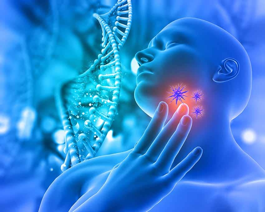 Angines maux de gorge